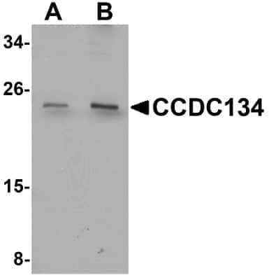 Western Blot: CCDC134 AntibodyBSA Free [NBP1-77053]