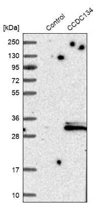 Western Blot: CCDC134 Antibody [NBP1-82125]