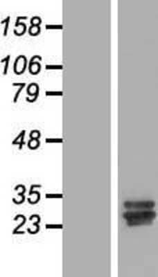 Western Blot: CCDC134 Overexpression Lysate [NBL1-08779]