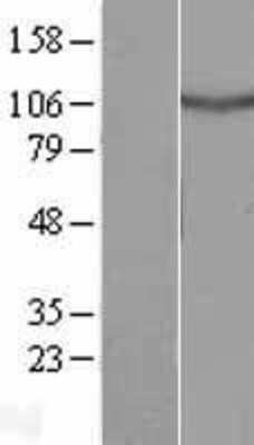 Western Blot: CCDC135 Overexpression Lysate [NBL1-08780]