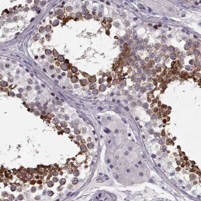 Immunohistochemistry-Paraffin: CCDC136 Antibody [NBP2-58816]