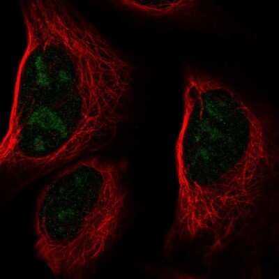 Immunocytochemistry/ Immunofluorescence: CCDC137 Antibody [NBP2-55713]