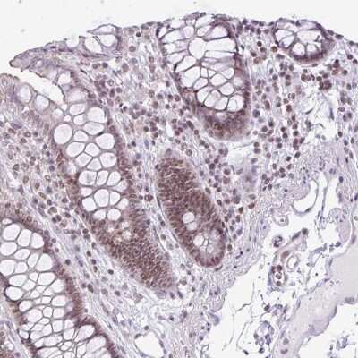 Immunohistochemistry-Paraffin: CCDC137 Antibody [NBP2-31033]