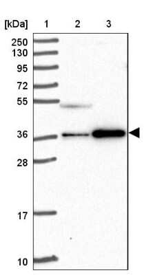 Western Blot: CCDC137 Antibody [NBP2-31033]