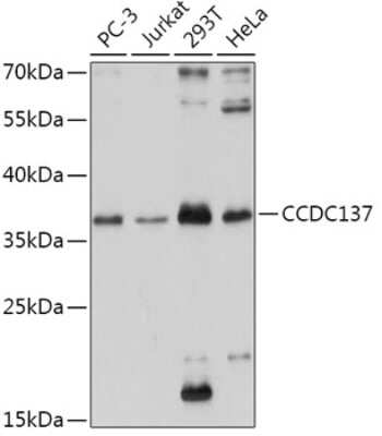 Western Blot: CCDC137 AntibodyAzide and BSA Free [NBP2-92389]