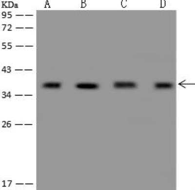 Western Blot: CCDC137 Antibody [NBP3-12572]