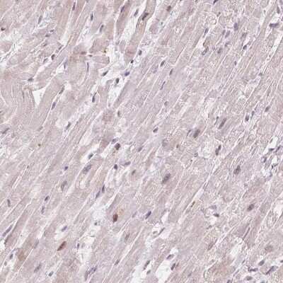 Immunohistochemistry-Paraffin: CCDC138 Antibody [NBP2-49123]