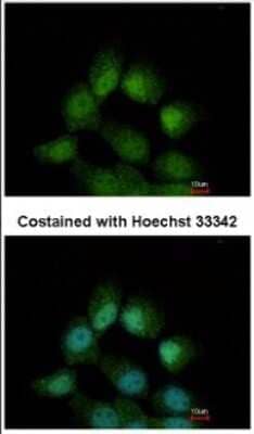 Immunocytochemistry/ Immunofluorescence: CCDC14 Antibody [NBP2-15742]
