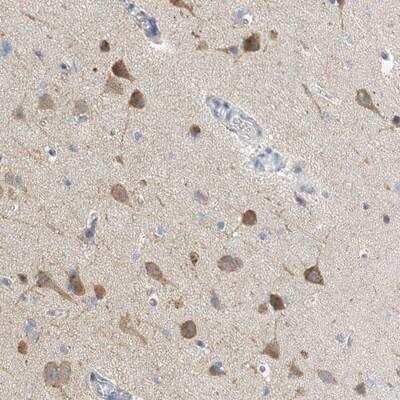 Immunohistochemistry: CCDC14 Antibody [NBP1-84183]