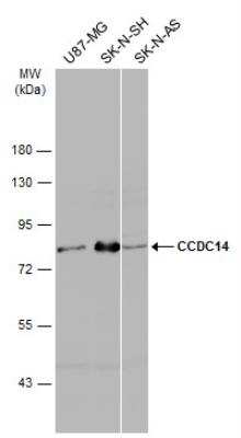 Western Blot: CCDC14 Antibody [NBP2-15742]