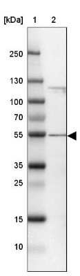 Western Blot: CCDC14 Antibody [NBP2-33998]