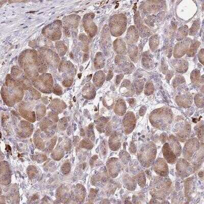Immunohistochemistry-Paraffin: CCDC140 Antibody [NBP2-14447]
