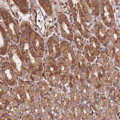 Immunohistochemistry-Paraffin: CCDC140 Antibody [NBP2-14795]