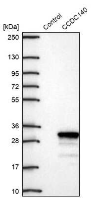 Western Blot: CCDC140 Antibody [NBP2-14447]