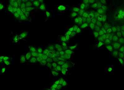 Immunocytochemistry/ Immunofluorescence: CCDC141 Antibody [NBP3-05861]