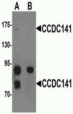 Western Blot: CCDC141 AntibodyBSA Free [NBP2-81896]