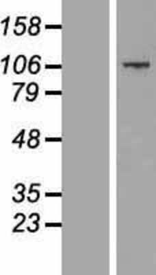 Western Blot: CCDC141 Overexpression Lysate [NBP2-05127]