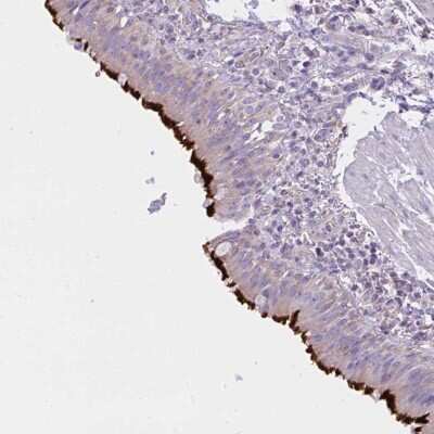 Immunohistochemistry-Paraffin: CCDC142 Antibody [NBP2-34159]