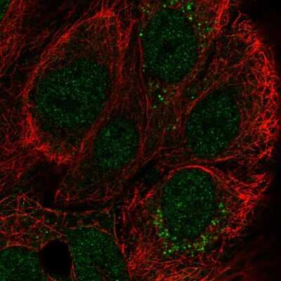 Immunocytochemistry/ Immunofluorescence: CCDC144A Antibody [NBP2-55601]