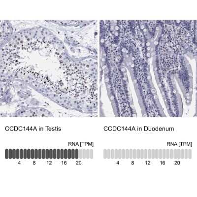 Immunocytochemistry/ Immunofluorescence: CCDC144A Antibody [NBP3-17075]