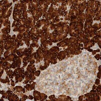 Immunohistochemistry: CCDC144A Antibody [NBP1-93756]