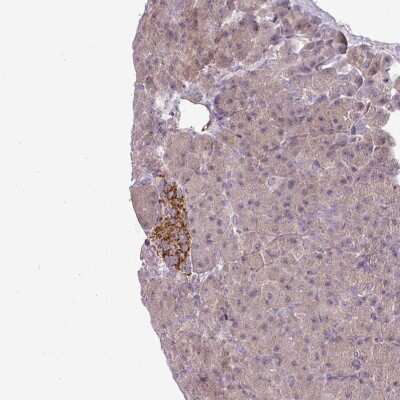 Immunohistochemistry: CCDC144A Antibody [NBP2-48881]