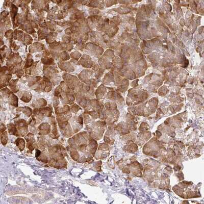 Immunohistochemistry-Paraffin: CCDC144A Antibody [NBP1-93756]