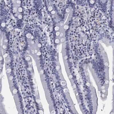 Immunohistochemistry-Paraffin: CCDC144A Antibody [NBP3-17075]