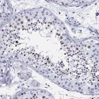 Immunohistochemistry-Paraffin: CCDC144A Antibody [NBP3-17075]