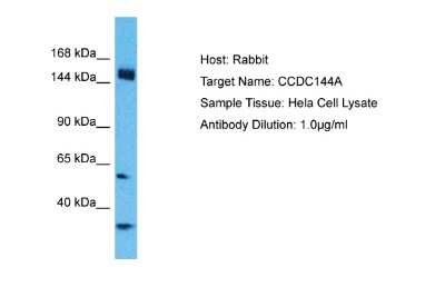 Western Blot: CCDC144A Antibody [NBP2-87142]