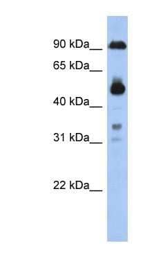 Western Blot: CCDC144B Antibody [NBP1-91467]