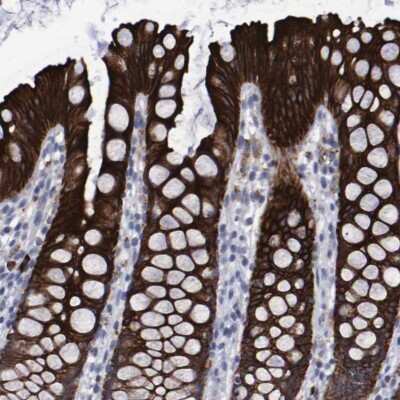 Immunohistochemistry-Paraffin: CCDC144NL Antibody [NBP2-14448]