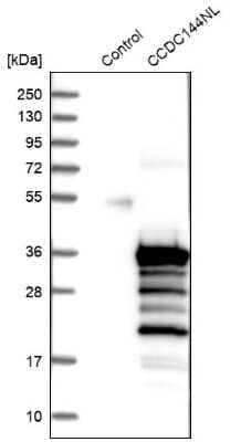 Western Blot: CCDC144NL Antibody [NBP2-14448]