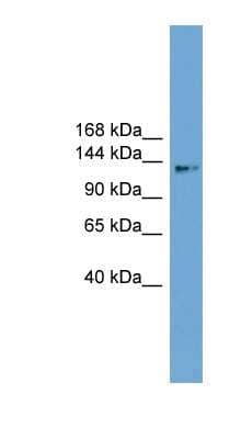 Western Blot: CCDC146 Antibody [NBP1-57040]