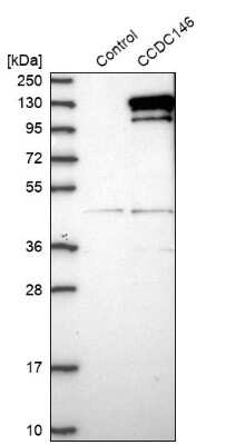 Western Blot: CCDC146 Antibody [NBP1-86432]