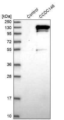 Western Blot: CCDC146 Antibody [NBP1-86433]