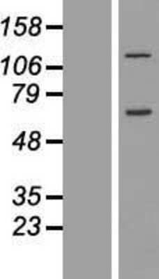 Western Blot: CCDC146 Overexpression Lysate [NBL1-08782]