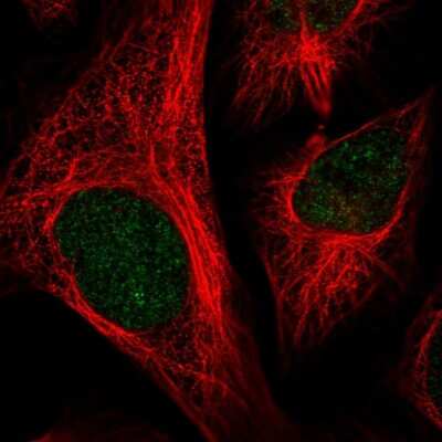 Immunocytochemistry/ Immunofluorescence: CCDC147 Antibody [NBP2-55437]