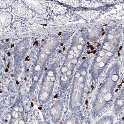 Immunohistochemistry: CCDC147 Antibody [NBP1-90782]