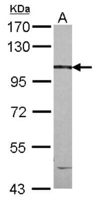 Western Blot: CCDC147 Antibody [NBP2-15743]