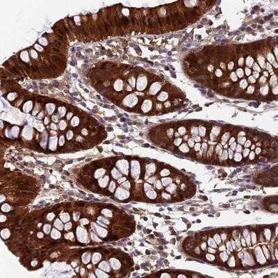 Immunohistochemistry-Paraffin: CCDC15 Antibody [NBP1-82264]