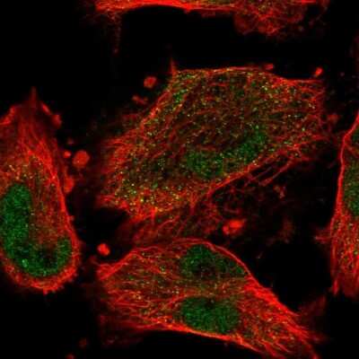 Immunocytochemistry/ Immunofluorescence: CCDC150 Antibody [NBP2-33514]