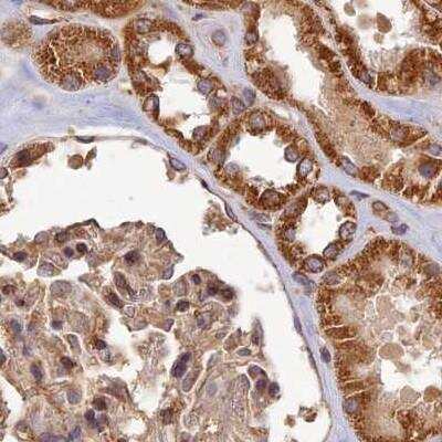 Immunohistochemistry-Paraffin: CCDC150 Antibody [NBP2-33409]