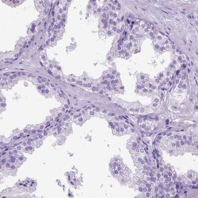 Immunohistochemistry-Paraffin: CCDC151 Antibody [NBP2-49140]