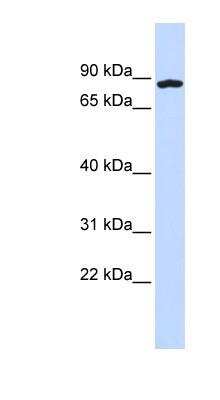 Western Blot: CCDC151 Antibody [NBP1-56716]