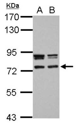 Western Blot: CCDC151 Antibody [NBP2-15744]