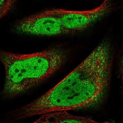 Immunocytochemistry/ Immunofluorescence: CCDC152 Antibody [NBP1-93555]