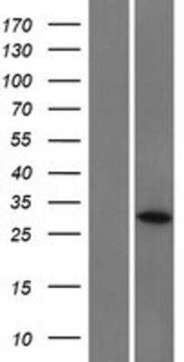 Western Blot: CCDC152 Overexpression Lysate [NBP2-09558]