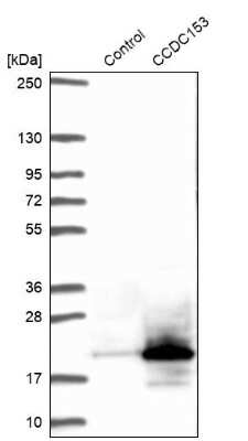 Western Blot: CCDC153 Antibody [NBP1-93549]