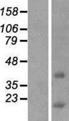 Western Blot: CCDC153 Overexpression Lysate [NBP2-08626]